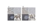 Immunohistochemical staining of human kidney, liver, lymph node and small intestine using Anti-SP100 antibody HPA016707 (A) shows similar protein distribution across tissues to independent antibody HPA017384 (B).