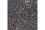 Immunohistochemical staining of human lymph node shows moderate to strong positivity in lymphoid cells.