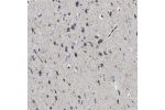 Immunohistochemical staining of human cerebral cortex shows moderate cytoplasmic positivity in neuronal cells.