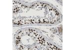 Immunohistochemical staining of human testis shows strong nuclear positivity in cells in seminiferous ducts.