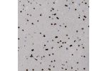 Immunohistochemical staining of human cerebral cortex shows strong nuclear positivity in glial cells.