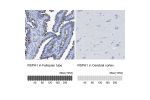 Immunohistochemistry analysis in human fallopian tube and cerebral cortex tissues using HPA016816 antibody. Corresponding RSPH1 RNA-seq data are presented for the same tissues.