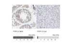 Immunohistochemistry analysis in human testis and liver tissues using HPA016820 antibody. Corresponding PCNT RNA-seq data are presented for the same tissues.