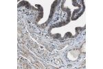 Immunohistochemical staining of human Fallopian tube shows strong cytoplasmic positivity in a subset of glandular cells.