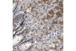 Immunohistochemical staining of human stomach shows cytoplasmic positivity in glandular cells.
