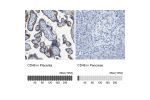 Immunohistochemistry analysis in human placenta and pancreas tissues using HPA016903 antibody. Corresponding CD46 RNA-seq data are presented for the same tissues.