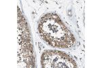Immunohistochemical staining of human testis shows strong membranous positivity in cells in seminiferous ducts.