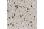 Immunohistochemical staining of human cerebral cortex shows strong cytoplasmic positivity in neurons.