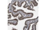 Immunohistochemical staining of human fallopian tube shows weak to moderate nuclear positivity in glandular cells.
