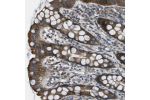 Immunohistochemical staining of human rectum shows strong cytoplasmic positivity in glandular cells.