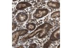 Immunohistochemical staining of human stomach shows strong cytoplasmic positivity in glandular cells.