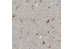 Immunohistochemical staining of human cerebral cortex shows moderate cytoplasmic positivity in neuronal cells.