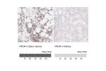Immunohistochemistry analysis in human bone marrow and kidney tissues using HPA017007 antibody. Corresponding PADI4 RNA-seq data are presented for the same tissues.
