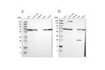 Western blot analysis using Anti-LTA4H antibody HPA017017 (A) shows similar pattern to independent antibody HPA008399 (B).