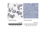 Immunohistochemistry analysis in human placenta and pancreas tissues using HPA017019 antibody. Corresponding TGFBI RNA-seq data are presented for the same tissues.