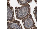 Immunohistochemical staining of human small intestine shows strong positivity in glandular cells.