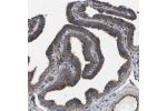 Immunohistochemical staining of human fallopian tube shows moderate to strong cytoplasmic positivity in glandular cells.