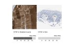 Immunohistochemistry analysis in human skeletal muscle and skin tissues using HPA017071 antibody. Corresponding DYSF RNA-seq data are presented for the same tissues.