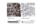 Immunohistochemistry analysis in human colon and placenta tissues using HPA017079 antibody. Corresponding SQRDL RNA-seq data are presented for the same tissues.