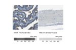 Immunohistochemistry analysis in human fallopian tube and lymph node tissues using Anti-MSLN antibody. Corresponding MSLN RNA-seq data are presented for the same tissues.