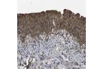 Immunohistochemical staining of human urinary bladder shows strong cytoplasmic positivity in urothelial cells.