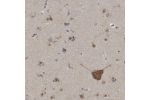 Immunohistochemical staining of human caudate shows moderate cytoplasmic and nuclear positivity in neuronal cells.