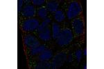 Immunofluorescent staining of human cell line RT4 shows localization to vesicles.