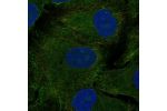 Immunofluorescent staining of human cell line A549 shows localization to plasma membrane.