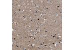 Immunohistochemical staining of human cerebral cortex shows strong nuclear positivity in neurons.