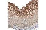 Immunohistochemical staining of human cervix, uterine shows moderate membranous/cytoplasmic positivity in squamous epithelial cells.