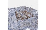 Immunohistochemical staining of human pancreas shows distinct cytoplasmic positivity in islet cells.