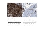 Immunohistochemistry analysis in human prostate and skeletal muscle tissues using HPA017330 antibody. Corresponding CALD1 RNA-seq data are presented for the same tissues.