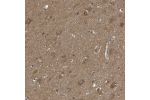 Immunohistochemical staining of human cerebral cortex shows strong cytoplasmic positivity in neurons.