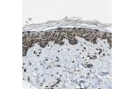 Immunohistochemical staining of human skin shows moderate to strong positivity in nuclear membrane in squamous epithelial cells.
