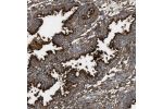 Immunohistochemical staining of human endometrium shows strong positivity in apical membrane in glandular cells.