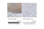 Immunohistochemistry analysis in human esophagus and skeletal muscle tissues using HPA017380 antibody. Corresponding CSTB RNA-seq data are presented for the same tissues.