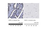 Immunohistochemistry analysis in human fallopian tube and cerebral cortex tissues using HPA017382 antibody. Corresponding RSPH1 RNA-seq data are presented for the same tissues.