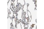 Immunohistochemical staining of human lung shows weak cytoplasmic positivity in macrophages.
