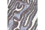 Immunohistochemical staining of human Fallopian tube shows moderate granular cytoplasmic positivity in glandular cells.