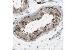 Immunohistochemical staining of human testis shows moderate to strong cytoplasmic positivity in cells in seminiferous ducts.