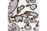 Immunohistochemical staining of human placenta shows strong positivity in trophoblastic cells.