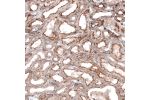 Immunohistochemical staining of human kidney shows moderate positivity in apical membrane in cells in tubules.
