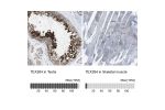 Immunohistochemistry analysis in human testis and skeletal muscle tissues using HPA017739 antibody. Corresponding TEX264 RNA-seq data are presented for the same tissues.
