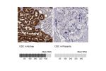 Immunohistochemistry analysis in human kidney and lymph node tissues using Anti-DDC antibody. Corresponding DDC RNA-seq data are presented for the same tissues.