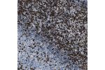 Immunohistochemical staining of human lymph node shows strong nuclear positivity in non-germinal center cells.