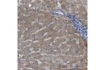 Immunohistochemical staining of human liver shows moderate cytoplasmic positivity in hepatocytes.