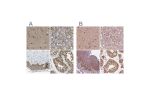 Immunohistochemical staining of human cerebral cortex, kidney, skin and testis using Anti-PSMC5 antibody HPA017871 (A) shows similar protein distribution across tissues to independent antibody HPA064293 (B).
