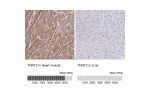 Immunohistochemistry analysis in human heart muscle and liver tissues using HPA017888 antibody. Corresponding TNNT2 RNA-seq data are presented for the same tissues.