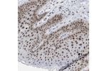Immunohistochemical staining of human skin shows strong nuclear positivity in squamous epithelial cells.