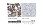 Immunohistochemistry analysis in human placenta and liver tissues using HPA017913 antibody. Corresponding COL15A1 RNA-seq data are presented for the same tissues.